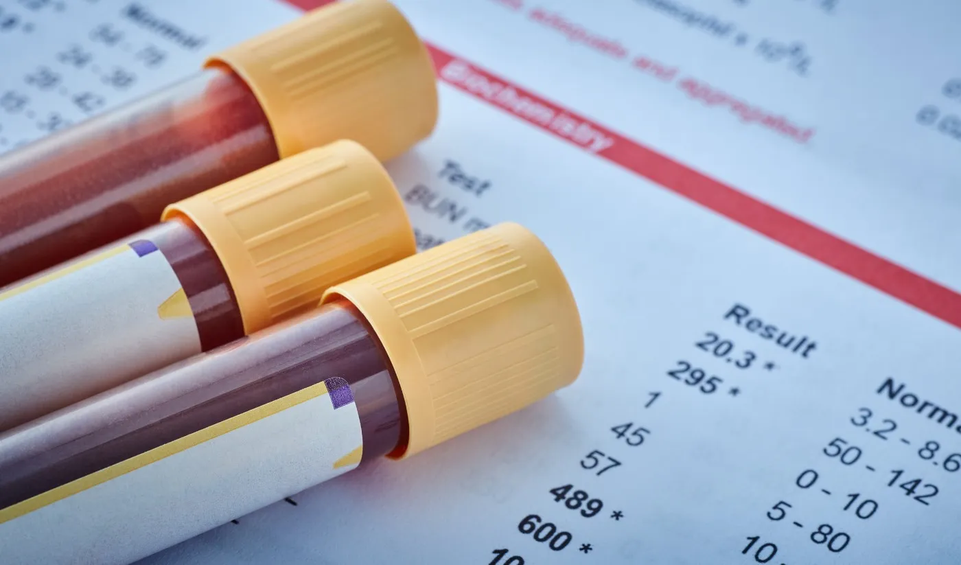 血液検査用の採血管と検査結果票